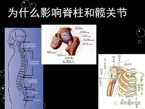 豆制品对强直性脊柱炎有影响吗