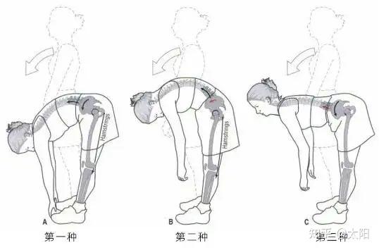 强直性脊柱炎能严重到什么地步