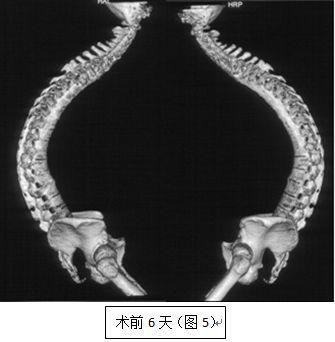 强直性脊柱炎会引起耳朵疾病吗