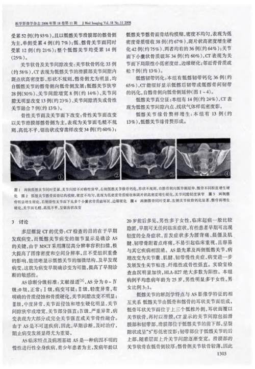 强直性脊柱炎对尿蛋白的影响