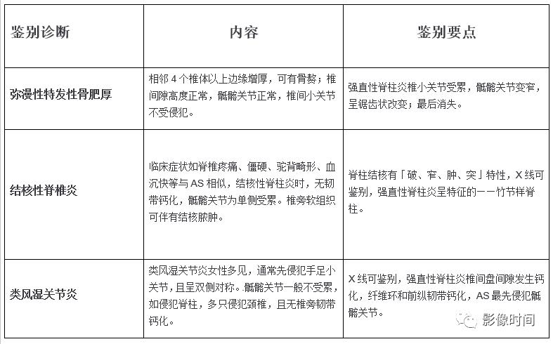 强直性脊柱炎诊断建议休息多久