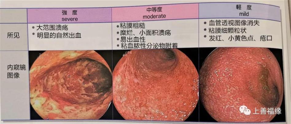 溃疡性结肠炎能吃西红柿鸡蛋么