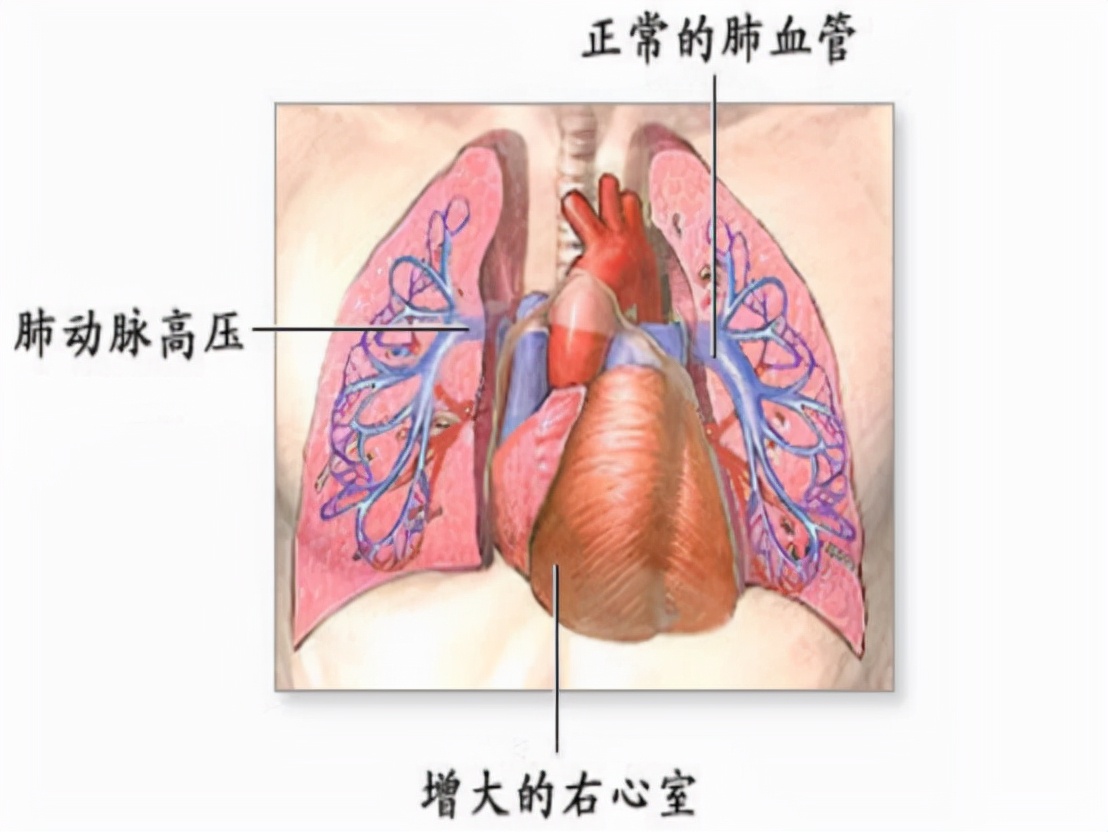 除了治疗功能障碍，西地那非还有4种作用，多点了解没坏处