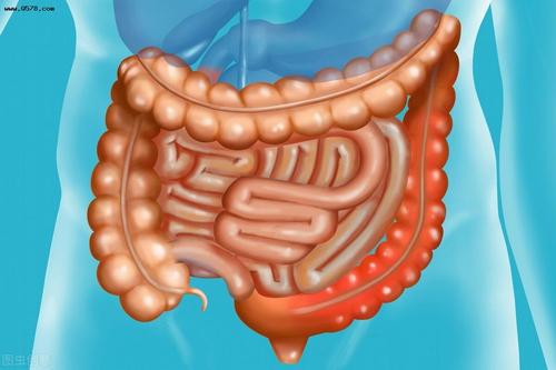 结肠多发溃疡和溃疡性结肠炎