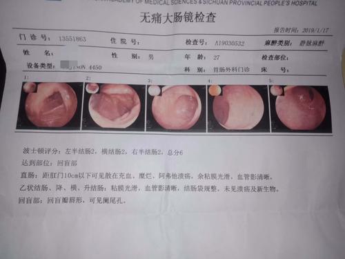 溃疡性结肠炎与直肠炎病因一样吗