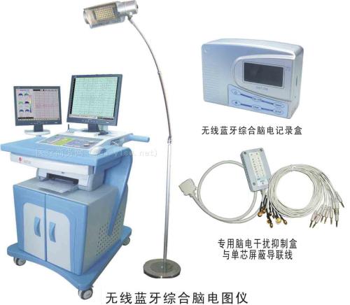 先天性肌强直