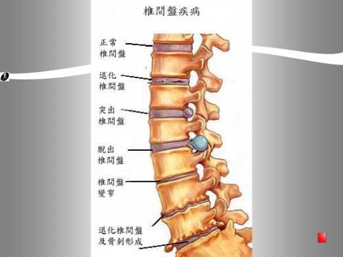 强直性脊柱炎不能做的动作