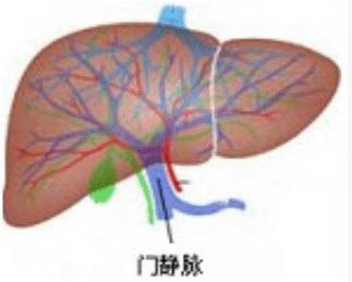 阿米巴脑炎