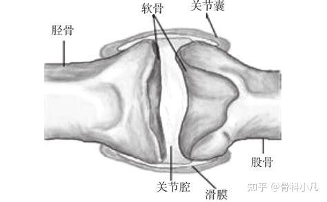 强直性脊柱炎关节囊腔积液