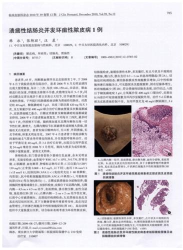 溃疡性结肠炎需要无麸质饮食吗