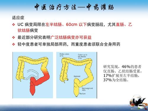 新冠疫苗对溃疡性结肠炎的影响