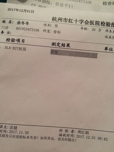 强直性脊柱炎检查