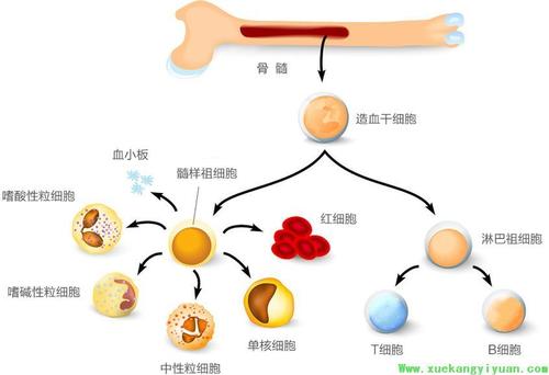 原发性骨髓纤维化