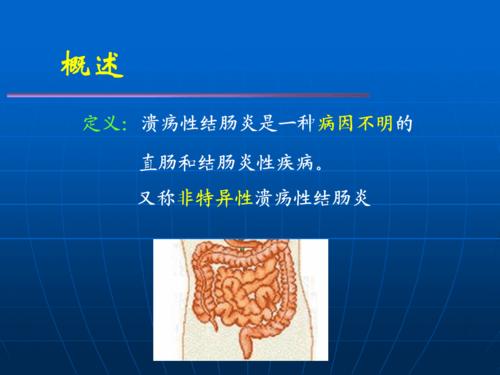 溃疡性结肠炎烩饼