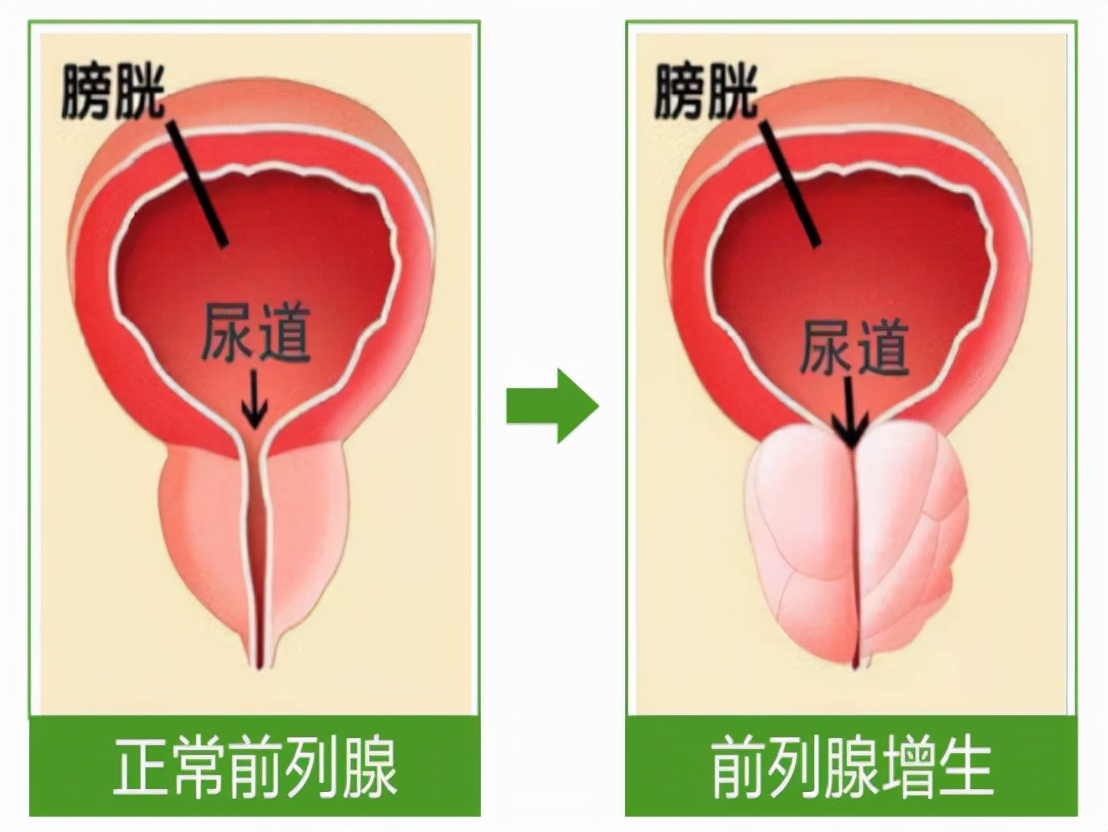 除了治疗功能障碍，西地那非还有4种作用，多点了解没坏处