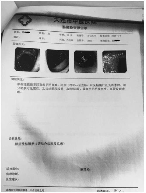 慢性非特异性溃疡性结肠炎中药