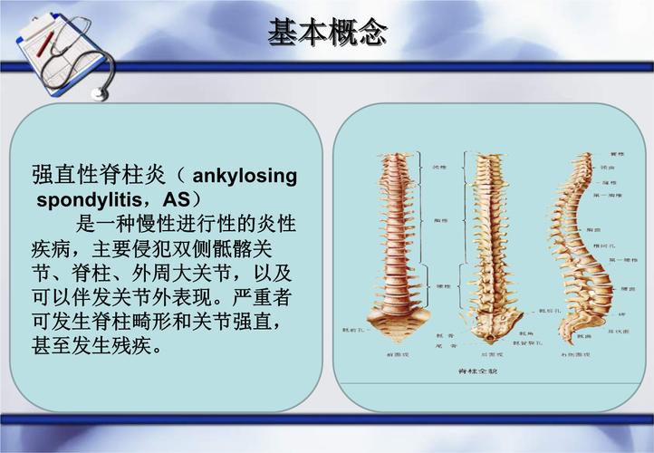 强直性脊柱炎与腰酸