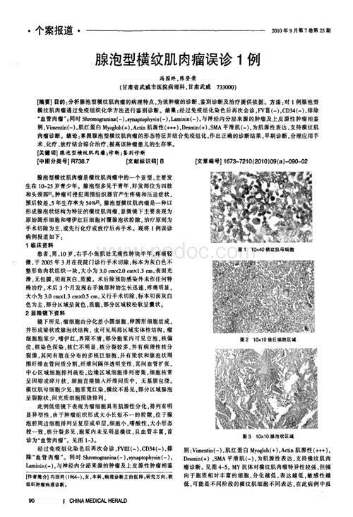 横纹肌肉瘤