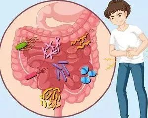 克隆病溃疡性结肠炎区别