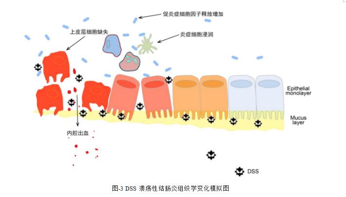 溃疡性结肠炎粪便标本