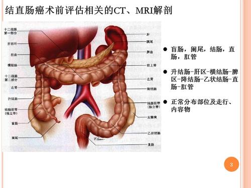 结直肠癌