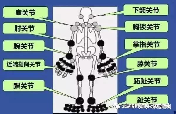 强直性脊柱炎会手指关节肿胀吗