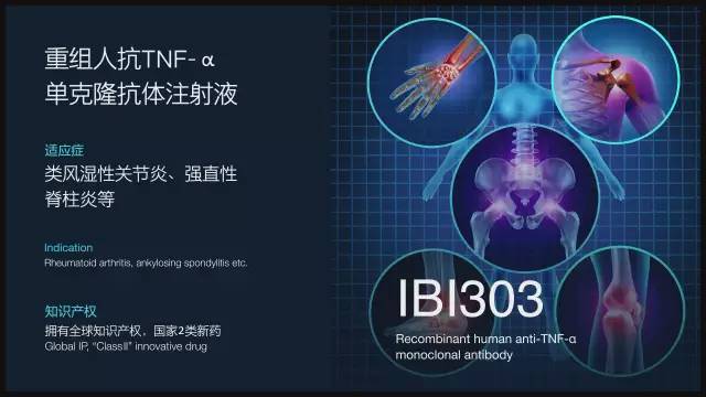 国外治疗强直性脊柱炎