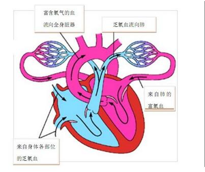 先心重度肺高：我想活着，但我没遇到“药神”，我吃不起药