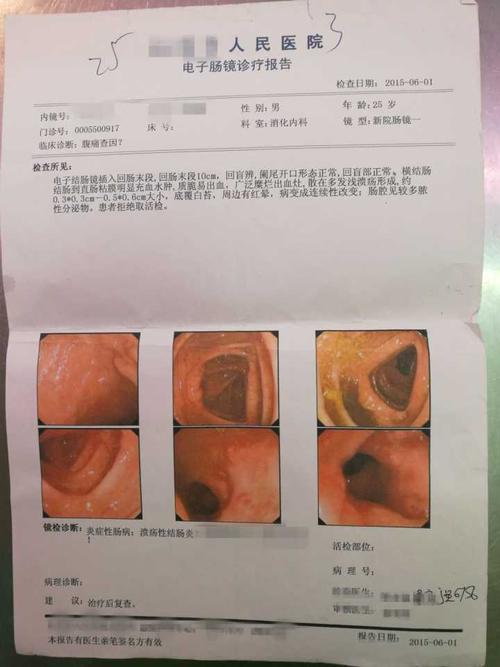 喉咙疼口腔溃疡溃疡性结肠炎