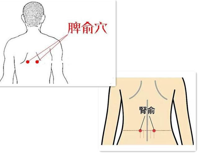 强直性脊柱炎按穴位图