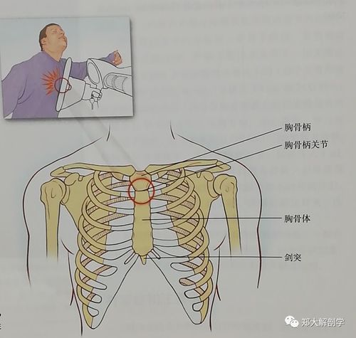 强直性脊柱炎胸腔疼痛严不严重