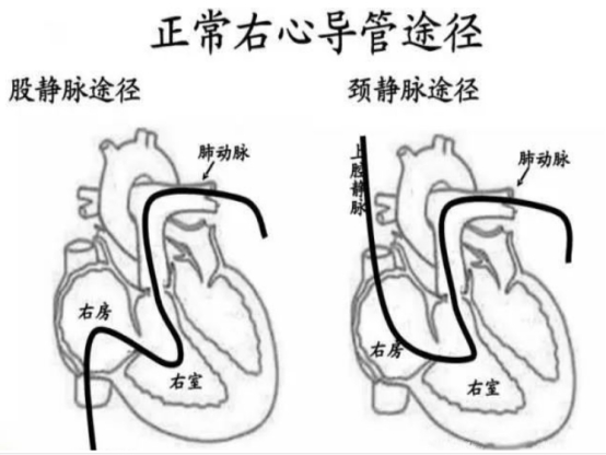 除了治疗功能障碍，西地那非还有4种作用，多点了解没坏处