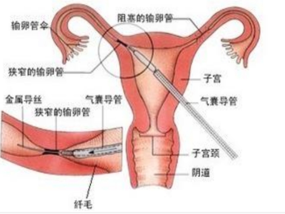 除了治疗功能障碍，西地那非还有4种作用，多点了解没坏处