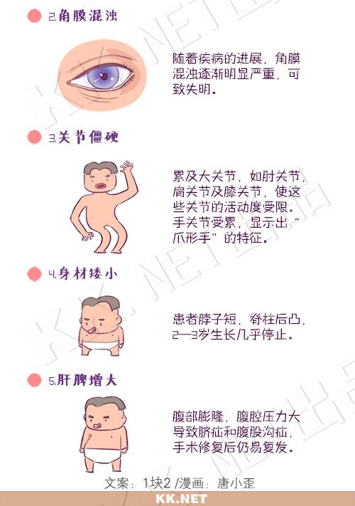 黏多糖贮积症