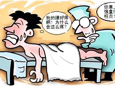 山东苗老师强直性脊柱炎