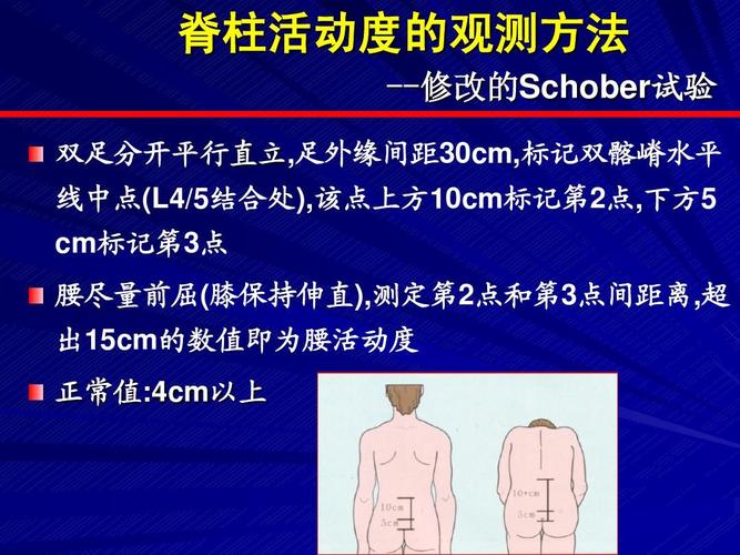 强直性脊柱炎最新治疗方法