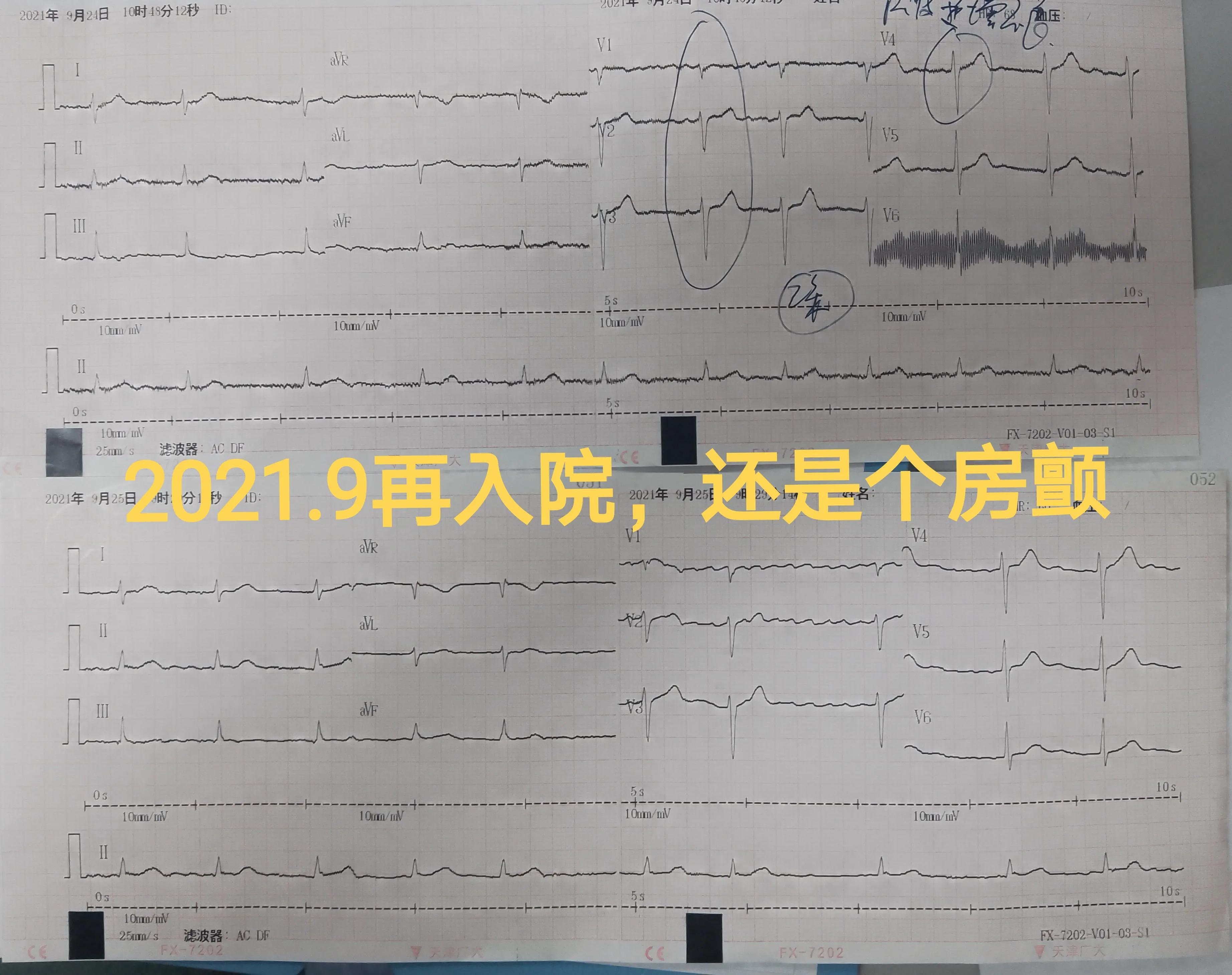 今天，我心脏科医生给一个女病人用了“伟哥”—