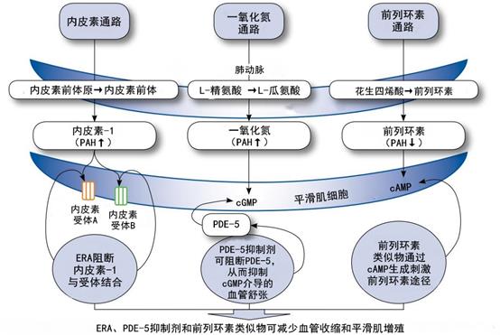 六张图表带你走进肺动脉高压的评估和处置