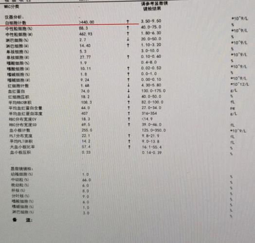 慢性粒细胞白血病