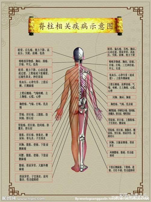 蚂蚁能治疗强直性脊柱炎吗