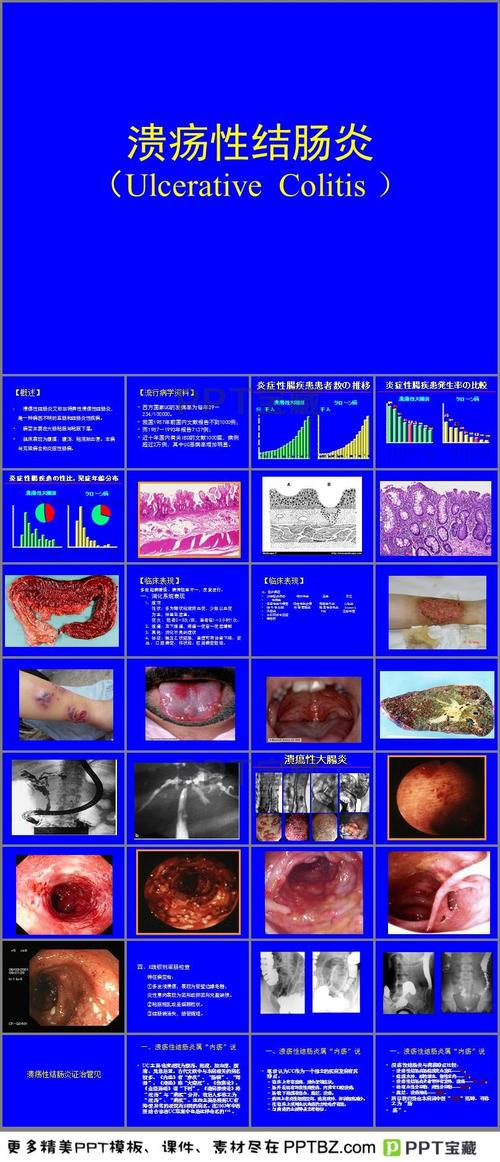 易蒙停禁用于溃疡性结肠炎为什么