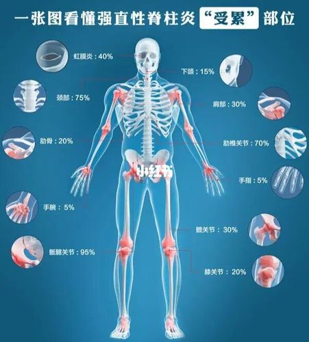 强直性脊柱炎多大年龄呈静止状态