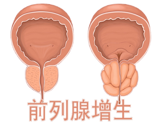 除了治疗功能障碍，西地那非还有4种作用，多点了解没坏处