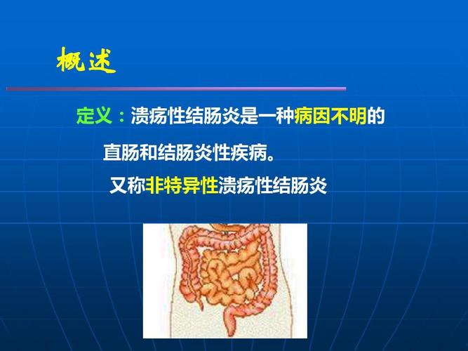 为何吸烟者患溃疡性结肠炎的少