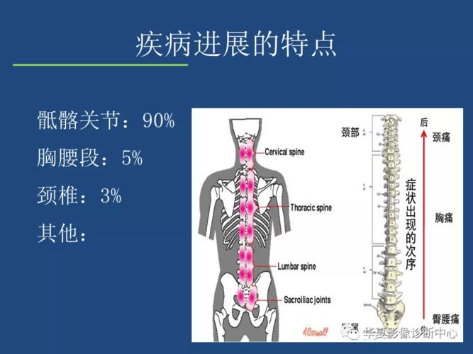 强直性脊柱炎胸片结果