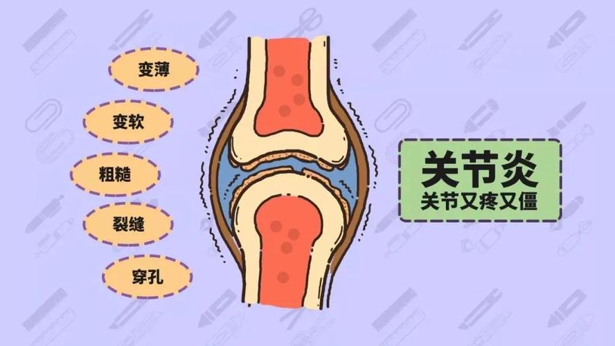 强直性脊柱炎膝关节硬