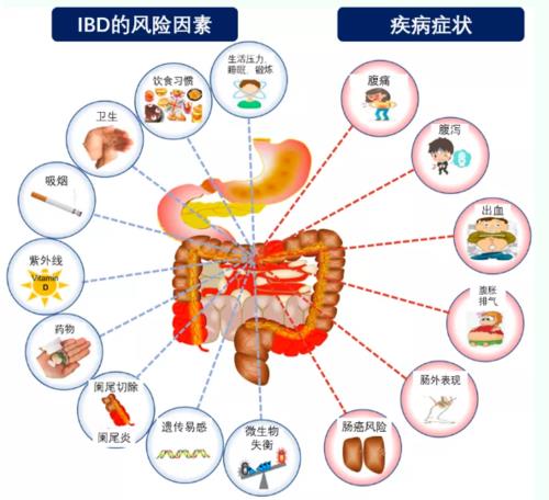 炎症性肠病与溃疡性结肠炎英文