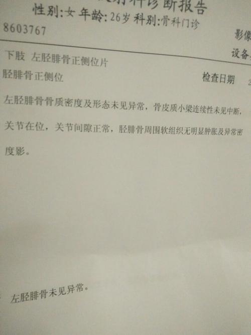 怎样检测自己强直性脊柱炎