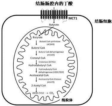 ?可乐必妥能治疗溃疡性结肠炎吗