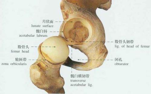 左边髋关节疼痛是强直性脊柱炎